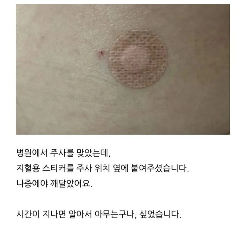 스티커