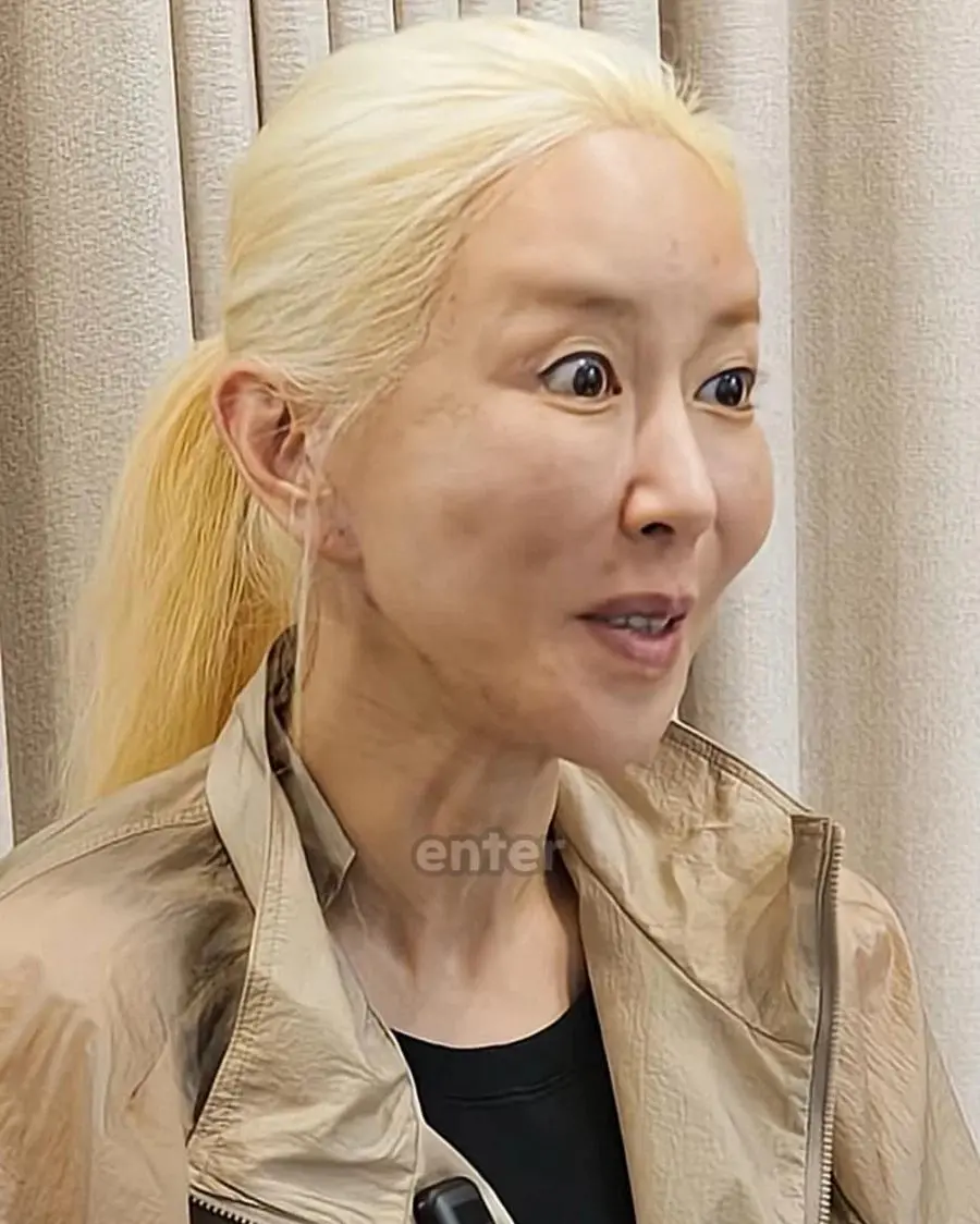  최근 나이가 보이는 슈 근황
